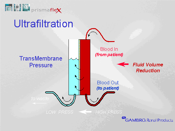 CRRT diagram